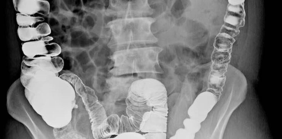 dr-edward-fynn-fluoroscopy-windhoek-north-namibia