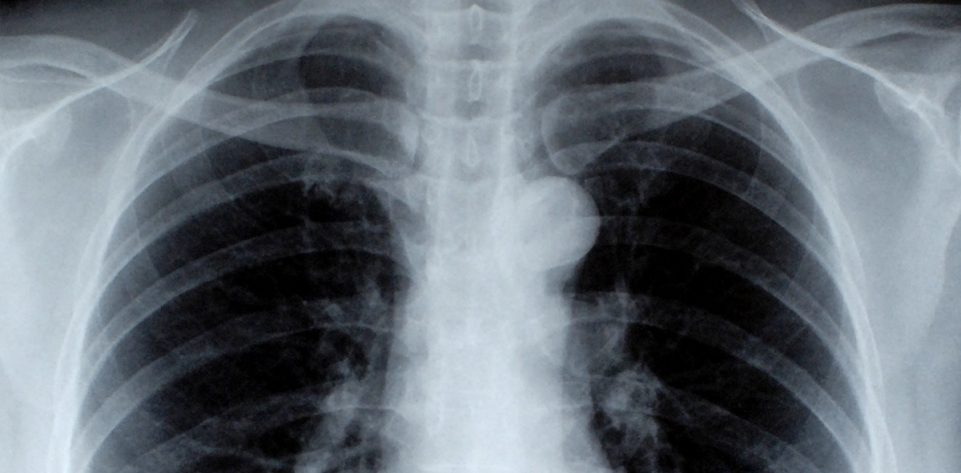 xray-dr-fynn-windhoek-namibia